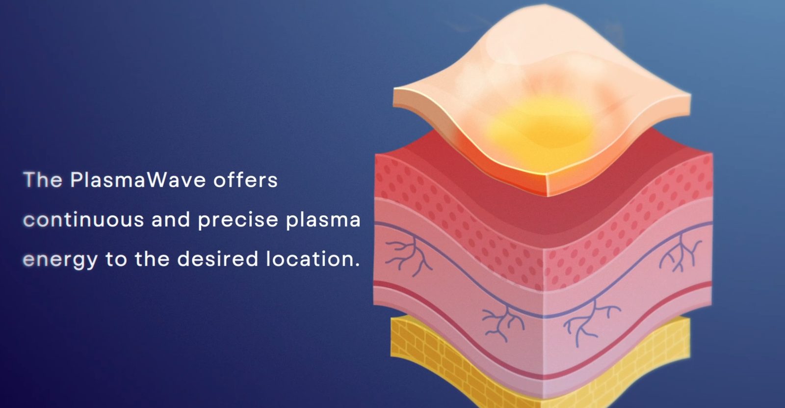 Plasma Wave