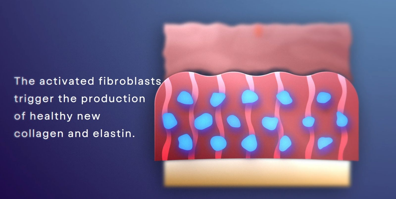 Plasma Wave